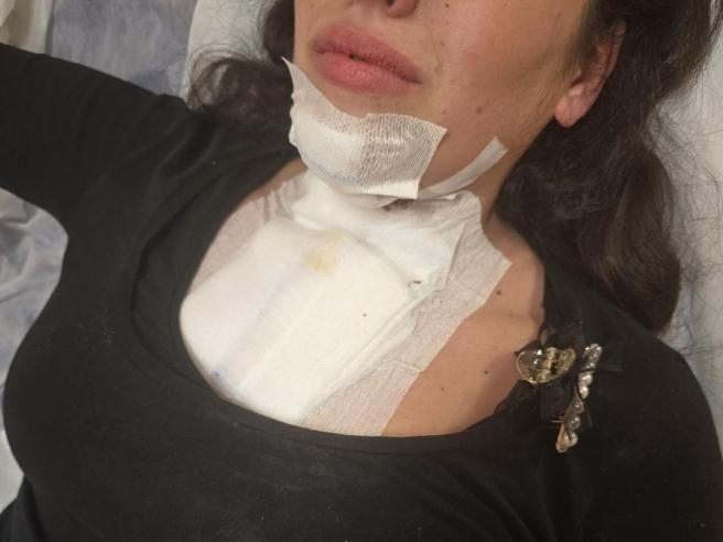 Terrore sulla statale del Vesuvio, pietre contro le auto: 'Mia moglie ferita, ho temuto morisse'