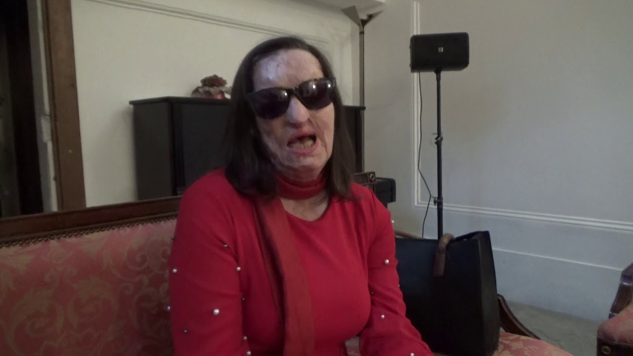 A Gragnano Filomena Lamberti, in biblioteca la testimonianza della donna sfigurata dal marito con l'acido
